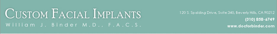 Custom Facial Implants - William J. Binder M.D., F.A.C.S.